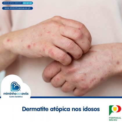 Dermatite atópica nos idosos